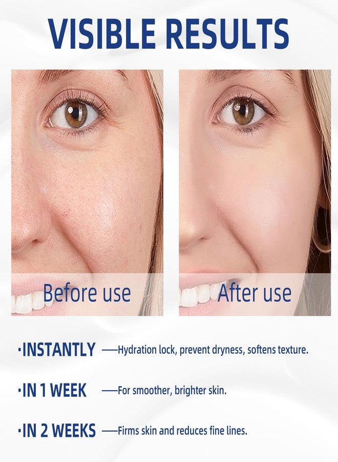 ايريف كريم ريتينول وفيتامين سي، مرطب للوجه، كريم مرطب للوجه 2 في 1 للاستخدام ليلاً ونهاراً، مرطبات يومية، مرطب للوجه للبشرة الجافة، مرطب خفيف الوزن 3.53 أونصة - Image 3